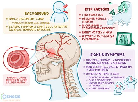 Carotid Artery Pain Symptoms