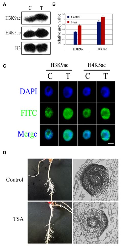 | Schematic representation of histone acetylation regulation in lateral ...