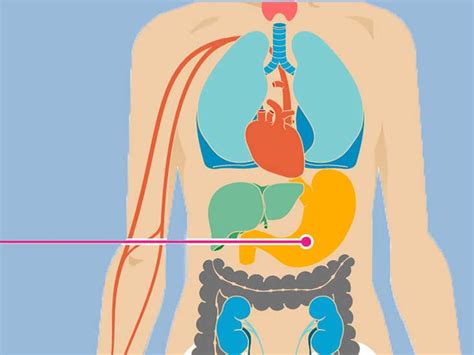 Chemotherapy Side Effects: 18 Ways Chemo Affects You