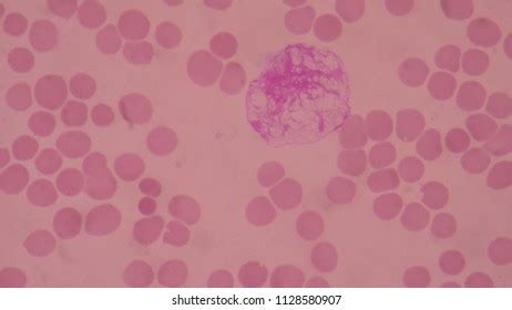 203 Red Blood Cells Flowing In Blood Vessel Stock Photos, Images ...