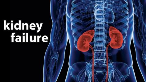 What Is Kidney Failure? Cause, Symptoms, Treatments | Healthtian