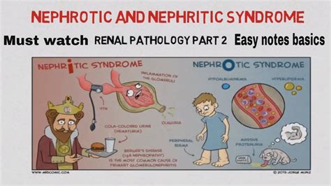 Nephrotic and nephritic syndrome - Causes , introduction EASY NOTES ...