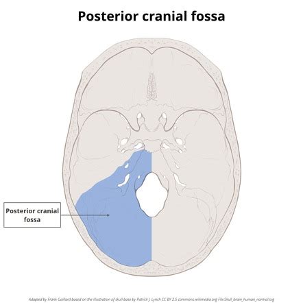 Posterior Fossa