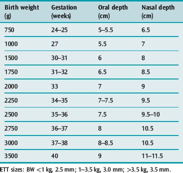 Equipment for paediatric intensive care | Anesthesia Key