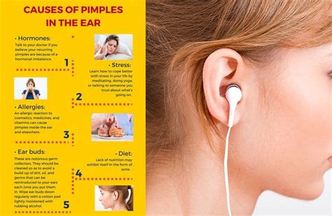 Amazing Ways To Get Rid of Pimple inside Ear