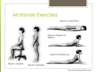 Mechanical diagnosis & therapy mckenzie method | PPT