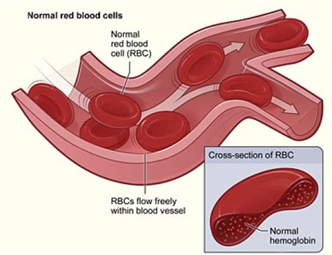 What is the Difference Between Intravascular and Extravascular ...