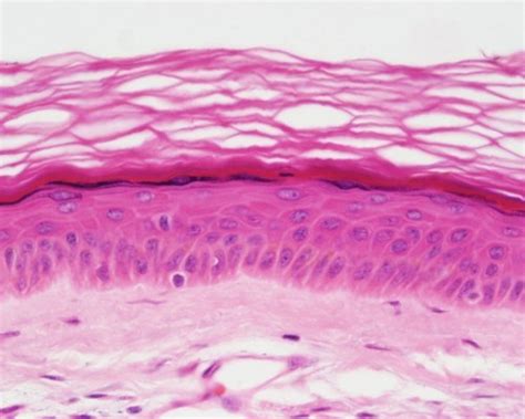 Medical School • Keratinized Stratified Squamous Epithelium