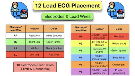 12 Lead ECG Placement: Diagram And Mnemonic For Limb And, 52% OFF