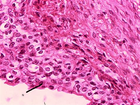 Transitional Epithelial 40x (corrected version) | Histology