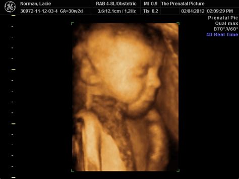 The Norman Family Blog....: 4D Ultrasound (30 Weeks & 2 Day)