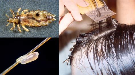 Does Lice Live In Carpet | www.cintronbeveragegroup.com