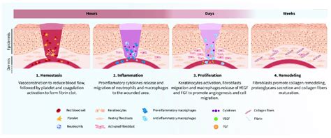 Wound healing process phases. 1. Hemostasis. Rupture of the veins ...