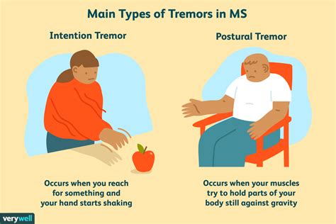 Tremor Hand : Tremor Disorder or Parkinson's - YouTube - Latest ...