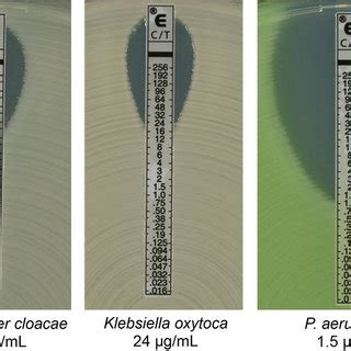 Interpretation of Etest results. C/T Etest strips were placed onto ...