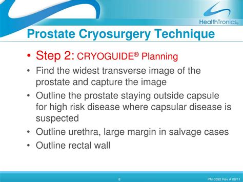 PPT - Prostate Cryosurgery PowerPoint Presentation, free download - ID ...