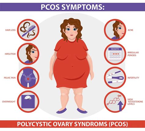 Pcos Symptoms Infographic. Polycystic Ovary Syndrome. Detailed V – Dr ...