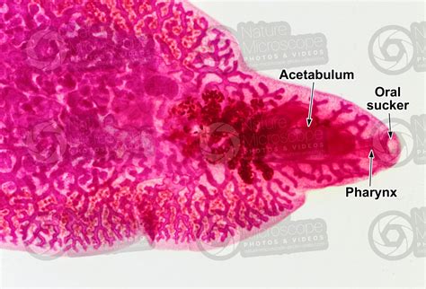 Fasciola hepatica. Common liver fluke. Fascioliosis. 6X - Trematoda ...