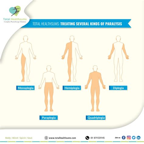 Paraplegia: Definition, Causes, Symptoms, Types Treatment