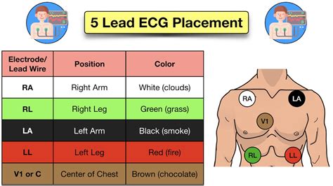 How to Place a 5 Lead ECG: Acronym, Mnemonic, Diagram for Electrode ...