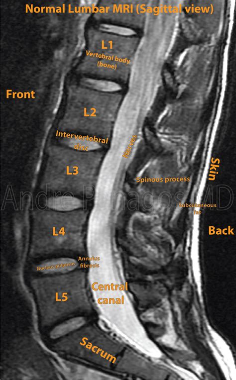 Will A Lumbar Mri Show Hip Problems - mapasgmaes