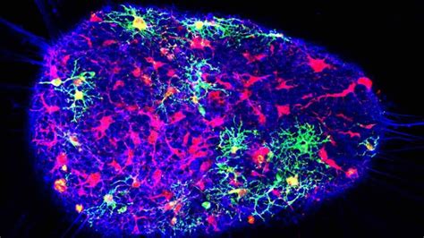 Scientists Create 3D Mini Brain Models From Human Stem Cells for Research