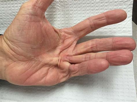 Shaky Hands: 10 Causes Of Shaky Hands