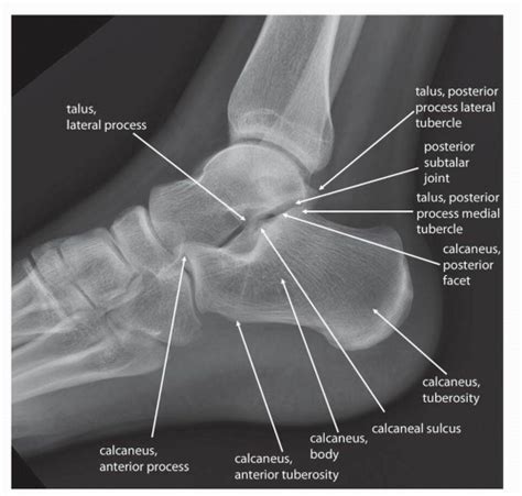 Lateral Ankle X Ray Anatomy