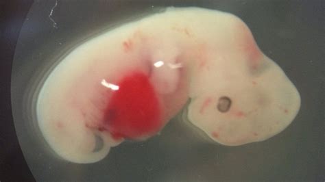 Human-pig 'chimera embryos' detailed - BBC News