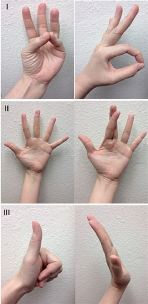 Motor examination of the hand. I: Median nerve. II: Ulnar nerve. III ...