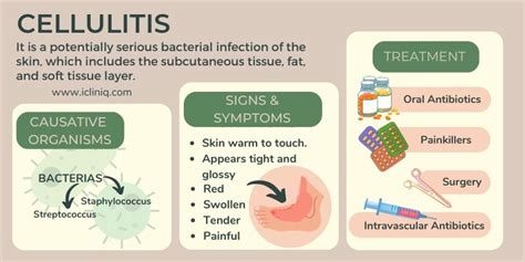 Cellulitis - Causes | Symptoms | Risks | Diagnosis | Treatment | Home ...