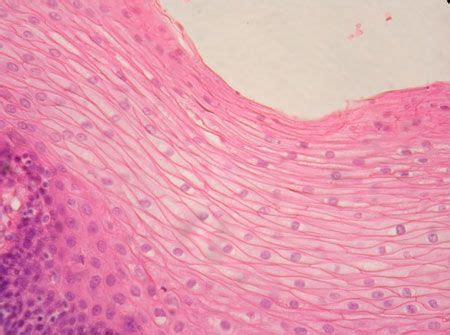 Stratified squamous epithelium | Stratified squamous epithelium ...