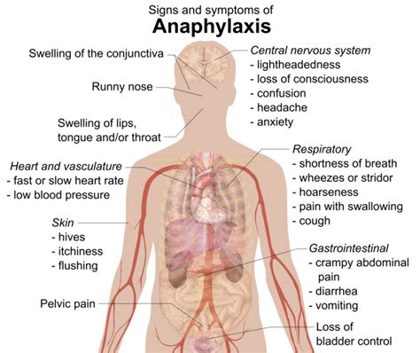 12.4A: Type I (Anaphylactic) Reactions - Biology LibreTexts