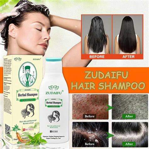 Zudaifu Herbal Shampoo 120ML Treatment Eczema Dermatitis Anti fungal ...