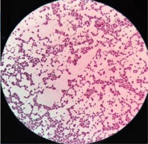 E Coli Gram Stain 100x