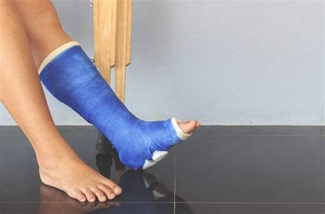 An Easier Recovery From Ankle Fractures | AICA Orthopedics