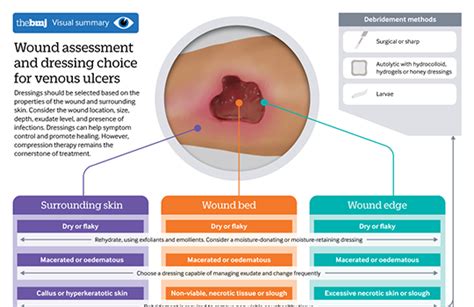 Dressings for venous leg ulcers | The BMJ