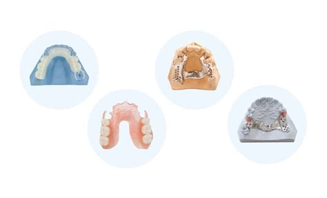 Types of Partial Dentures: How Do You Choose?