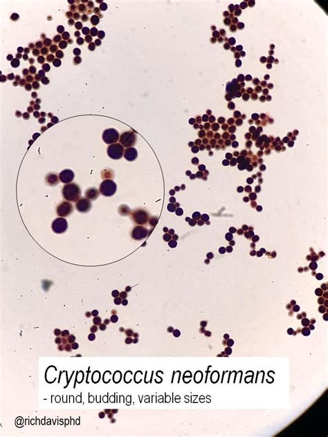 Cryptococcus Neoformans Gram Stain Morphology