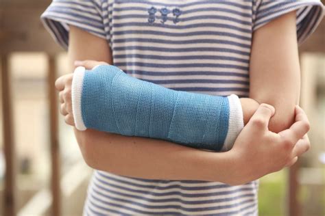 Treatment of Broken Bones – Fracture Care Options