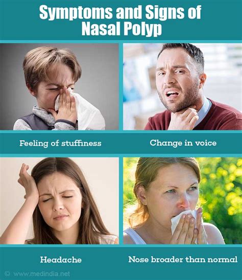 Nasal Sinus Cancer Symptoms