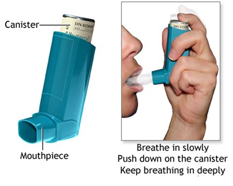 Asthma Attack Causes, Allergy, Triggers - Symptoms, Treatment Inhalers