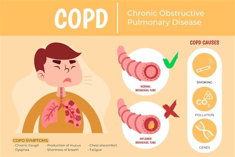 What is Chronic Obstructive Pulmonary Disease (COPD)