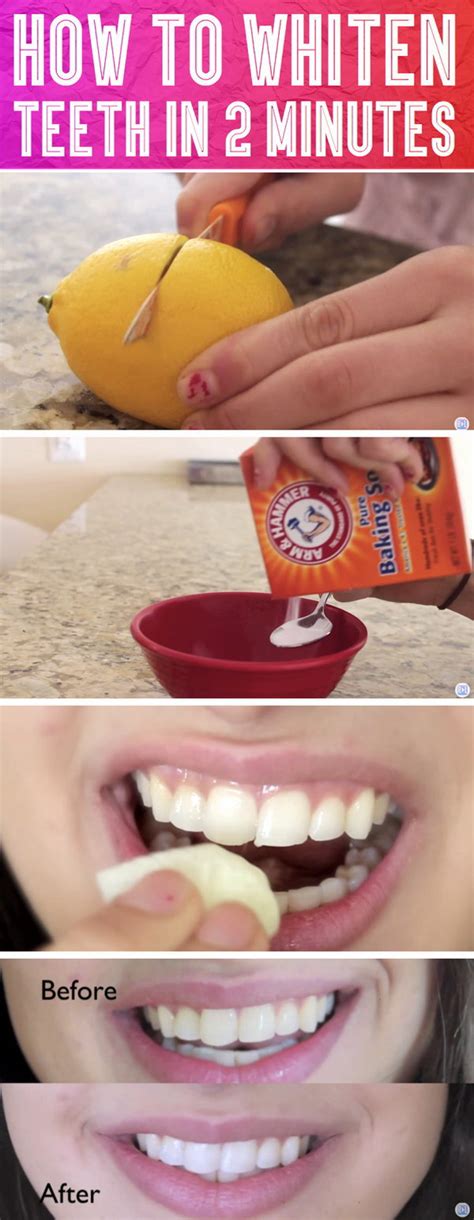 15 Natural Ways to Whiten Your Teeth: Homemade Teeth Whiteners 2017