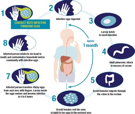 About Pinworm Infection (Enterobiasis)—Facts and Life Cycle