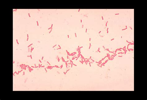 Public Domain Picture | Bacillus coagulans showing spores. Gram stain ...