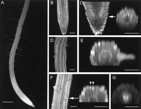 Root Hair Cell Microscope