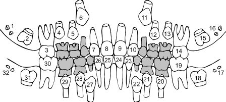 4 Dental Cast Analysis in the Mixed Dentition | Pocket Dentistry