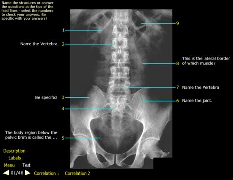 Abdomen - 1 - Abdominal Plain Film, AP View - Part 1 Diagram | Quizlet