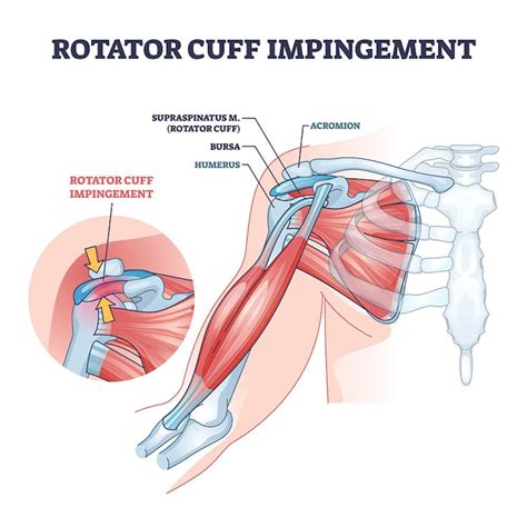 5 Shoulder Impingement Exercises to Boost Recovery | LaptrinhX / News